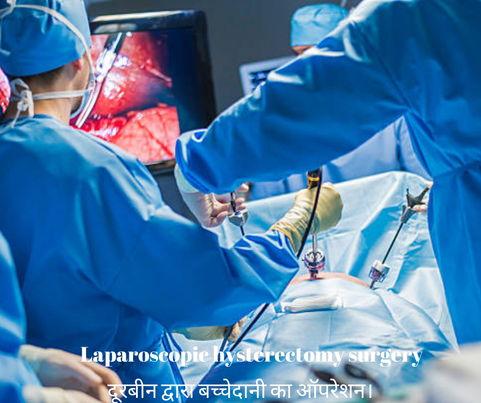 दूरबीन द्वारा बच्चेदानी का ऑपरेशन।