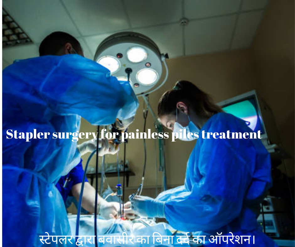 दूरबीन द्वाराpilesका ऑपरेशन।